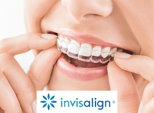 Invisalign® Treatment